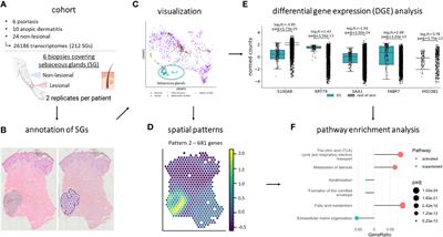 Spatial transcriptomics reveals altered lipid metabolism and inflammation-related gene expression of sebaceous glands in psoriasis and atopic dermatitis